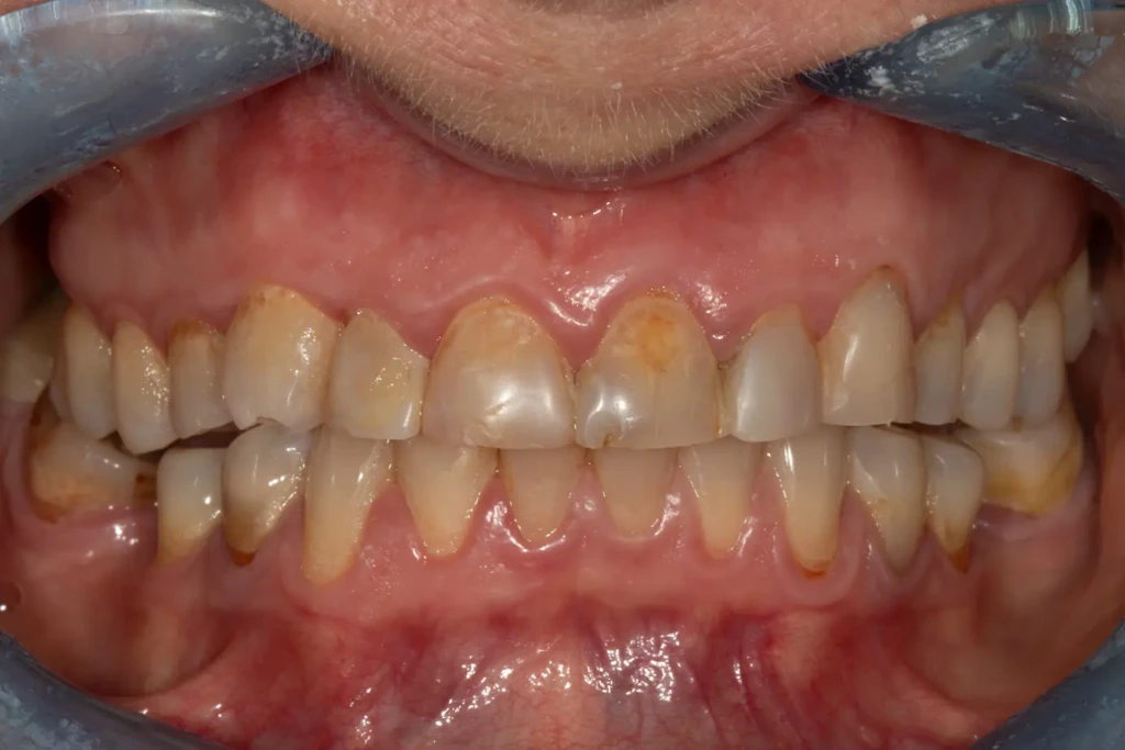 Metamorfoza 19 w Exacto Clinic Dentysta Poznań Dentysta Jarocin