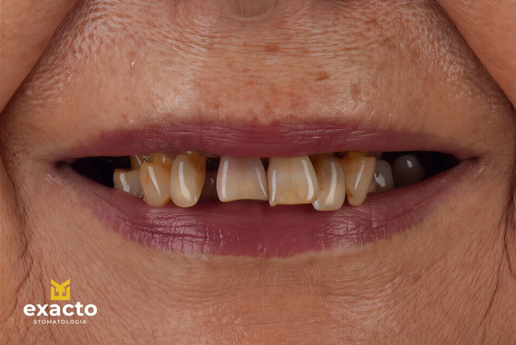 Metamorfoza w Exacto Clinic Dentysta Jarocin Dentysta Poznań