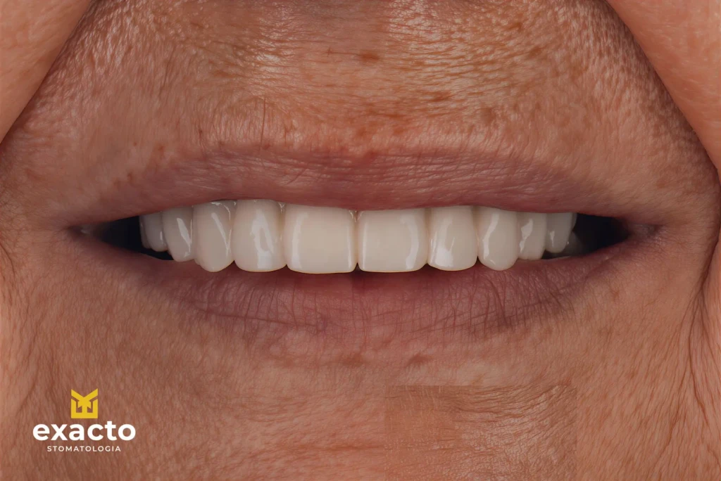 Metamorfoza w Exacto Clinic Dentysta Jarocin Dentysta Poznań