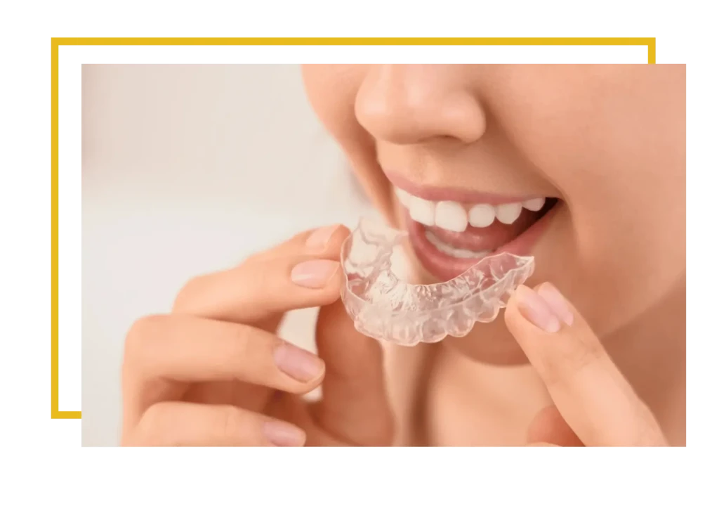 leczenie ortodontyczne nakładkami exacto