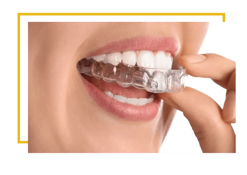 leczenie ortodontyczne exacto poznań