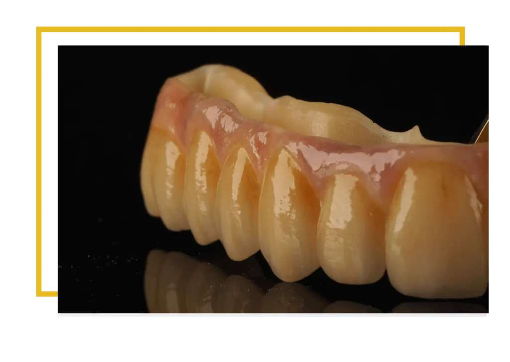 protezy zęby jaka proteza przy całkowitym braku zębów