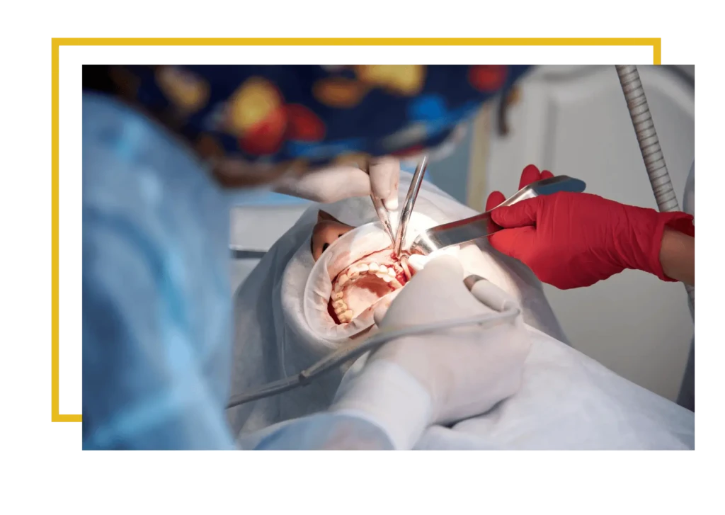 Podniesienie dna zatoki szczękowej — ile trwa?