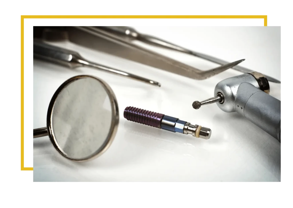 implanty stomatologiczne