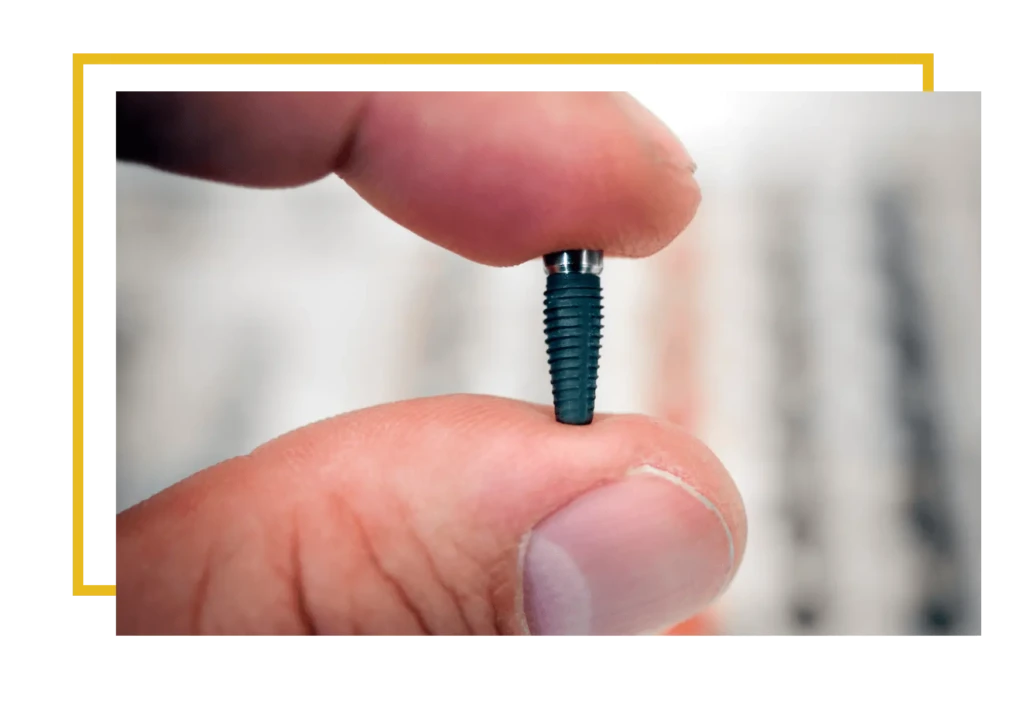 rodzaje implantów stomatologicznych