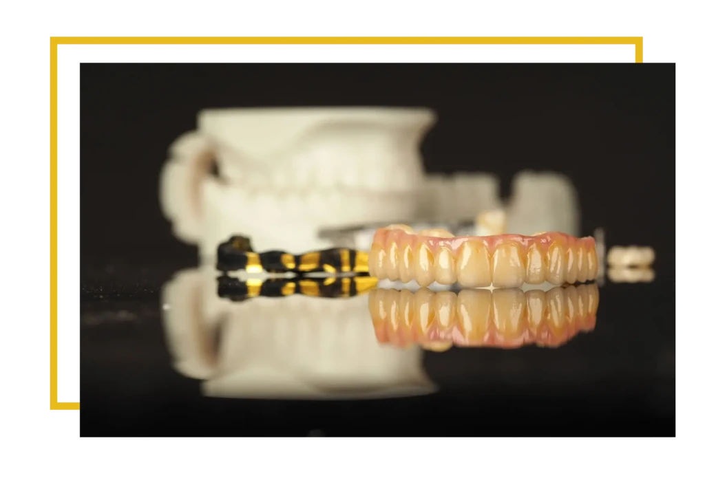 protetyka stomatologiczna