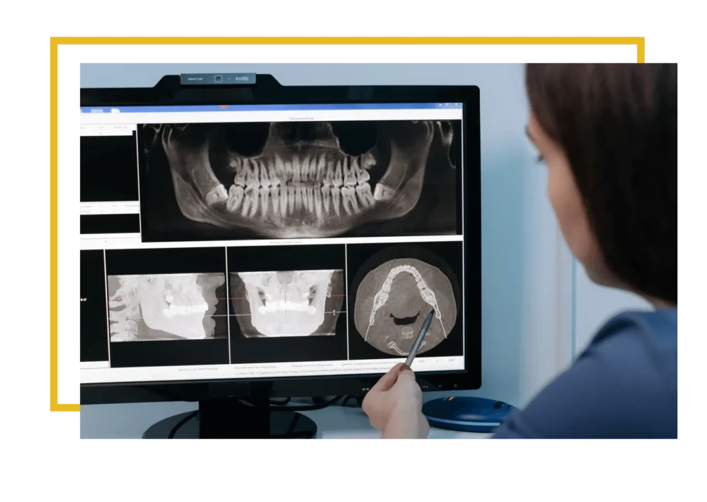 Czy implant zęba może się nie przyjąć