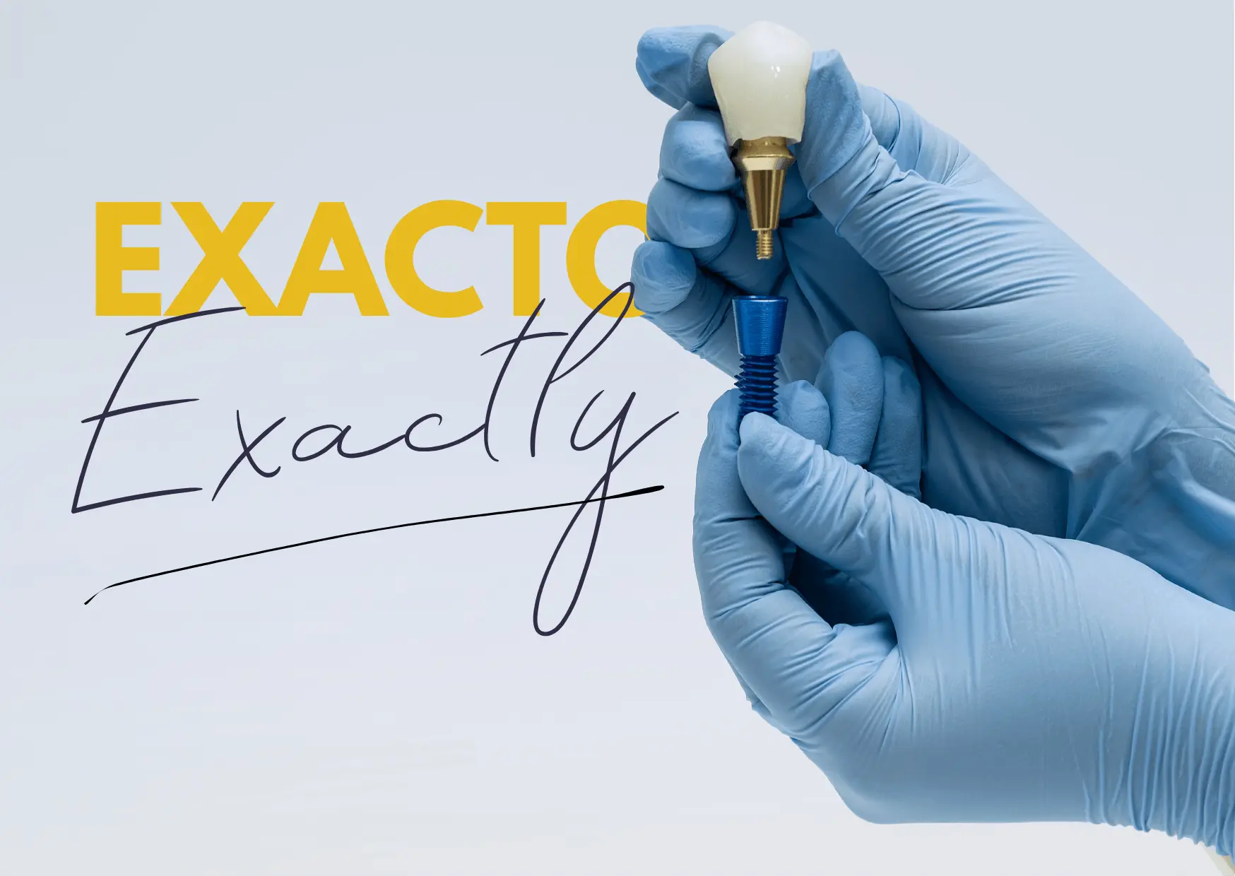 Implant stomatologiczny — najważniejsze pytania o zabieg wszczepienia implantów