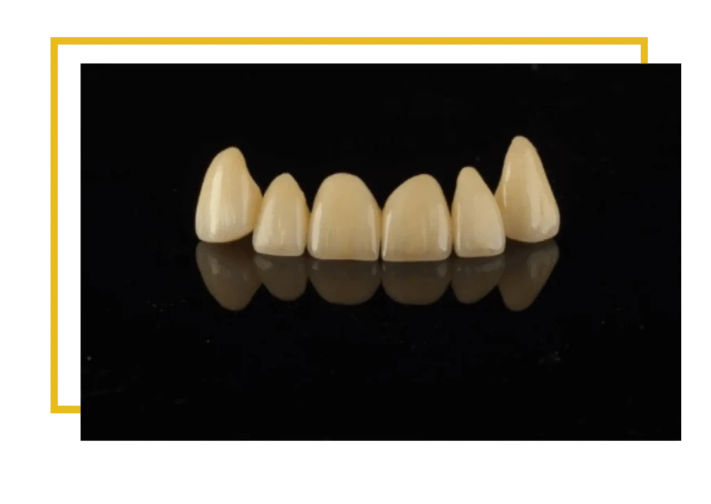 most porcelanowy na cyrkonie