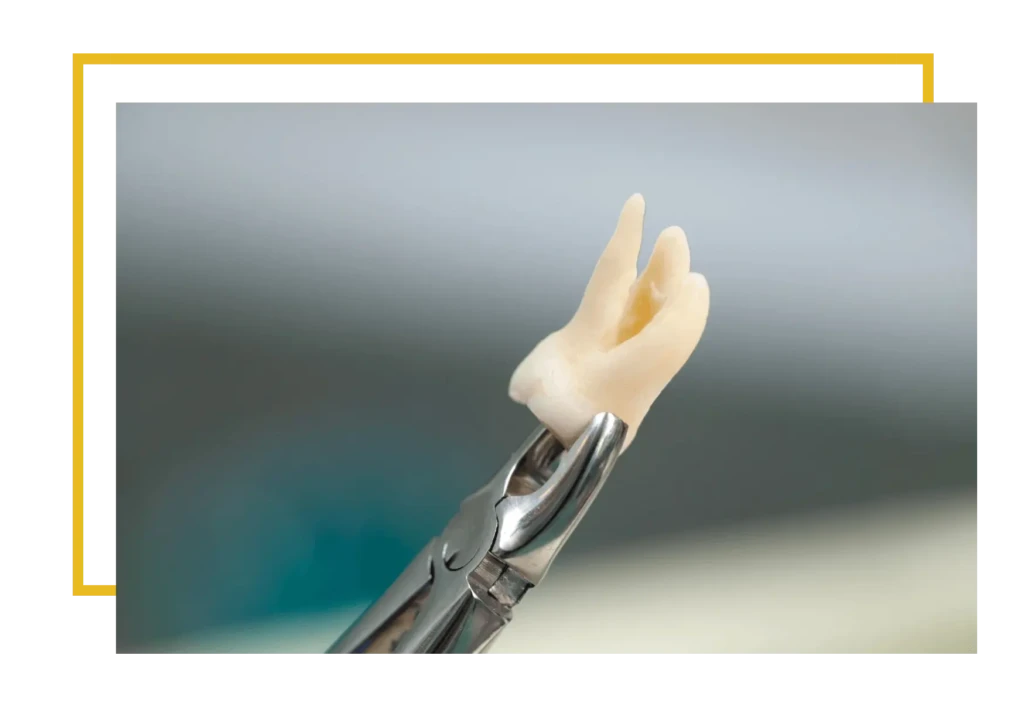 Zatrzymane ósemki mogą negatywnie wpływać na efekty leczenia ortodontycznego. Ich nacisk na sąsiednie zęby może powodować ich przesuwanie i niwelować rezultaty noszenia aparatu.