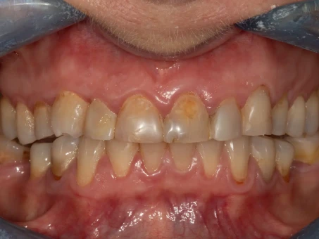 Metamorfoza 19 w Exacto Clinic Dentysta Poznań Dentysta Jarocin