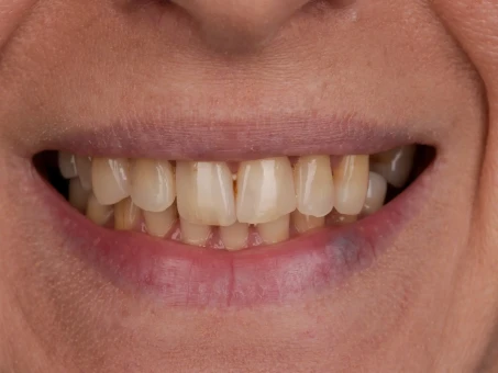 metamorfozy Exacto Clinic Dentysta Jarocin Dentysta Poznań