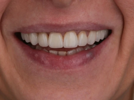 metamorfozy Exacto Clinic Dentysta Jarocin Dentysta Poznań