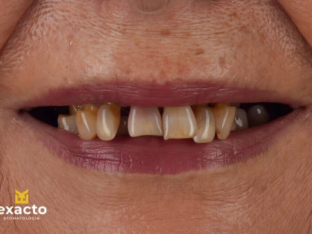 Metamorfoza w Exacto Clinic Dentysta Jarocin Dentysta Poznań