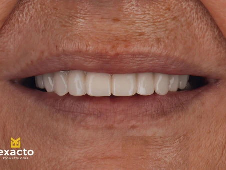 Metamorfoza w Exacto Clinic Dentysta Jarocin Dentysta Poznań