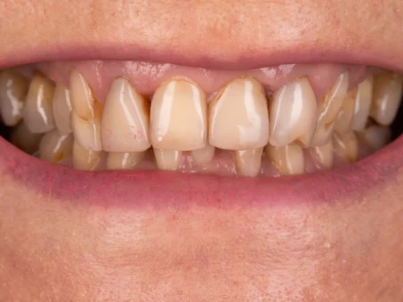 Metamorfoza Exacto Clinic Dentysta Jarocin Dentysta Poznań