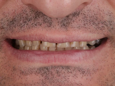 metamorfoza Exacto clinic dentysta poznań dentysta Jarocin